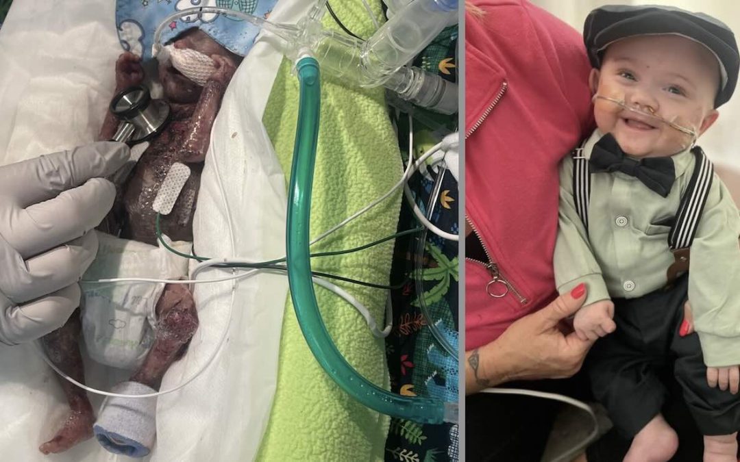 Guinness Record Holder for Most Premature Baby is Now Thriving at One Year Old–And All Giggles–After ‘Zero Odds’ to Live