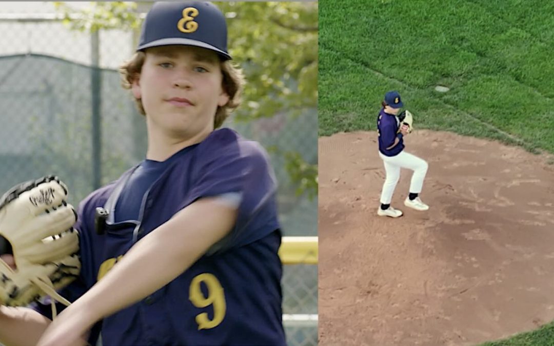 Hospital Tailors Kidney Transplant to Protect Teen Baseball Player’s Swing–Putting it on Other Side of his Body